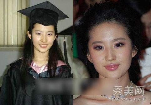 群星爆料明星整容视频